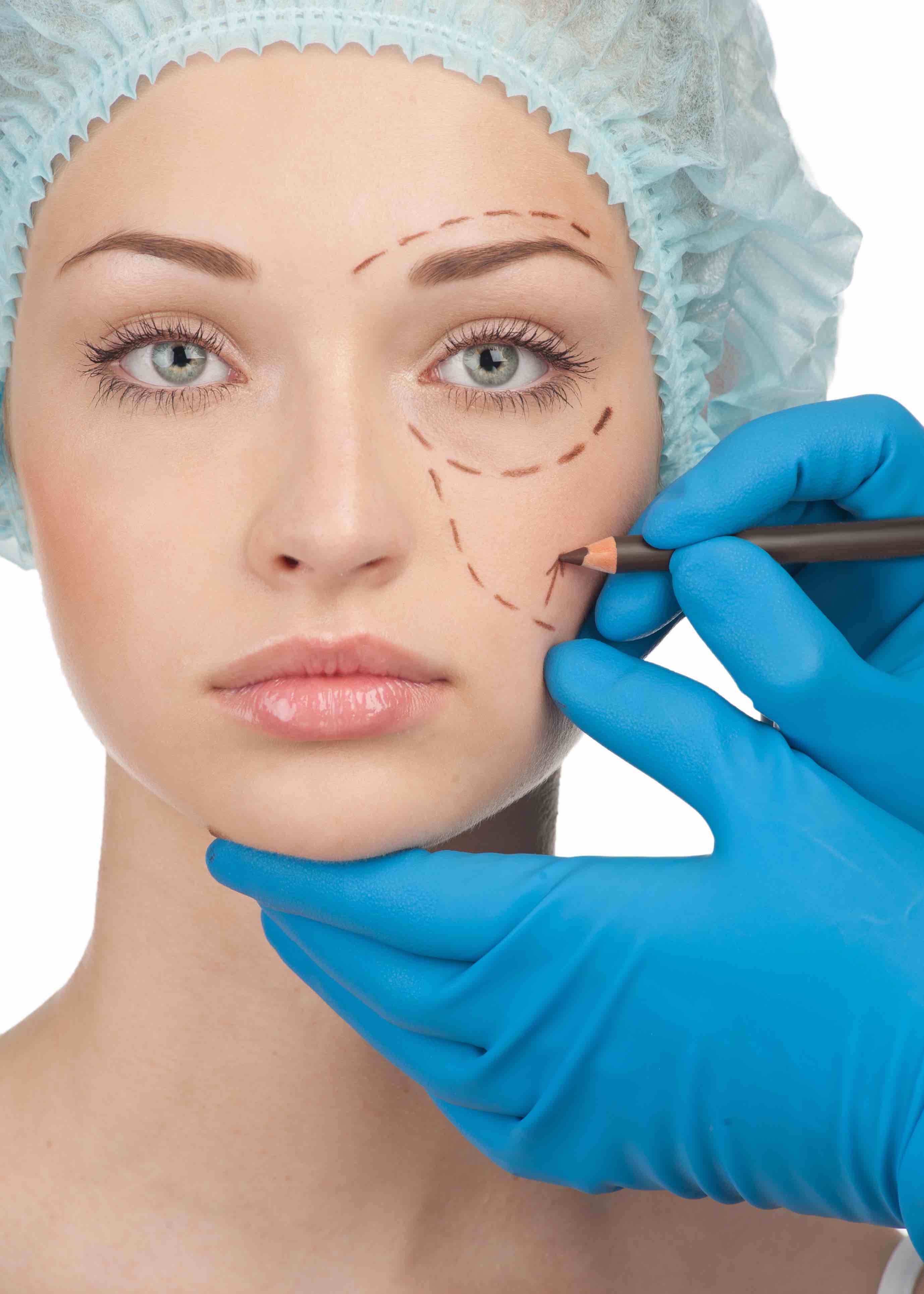 Woman with face marked up for cosmetic surgery 